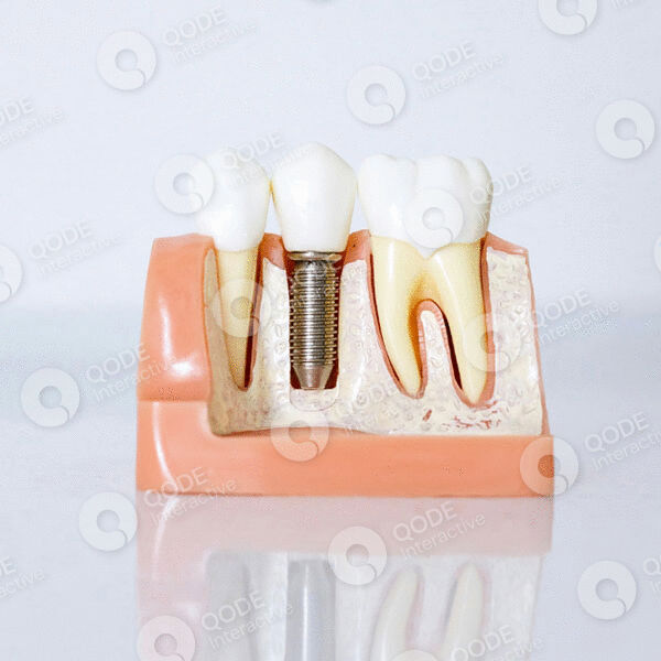 Smiling person after teeth whitening treatment
