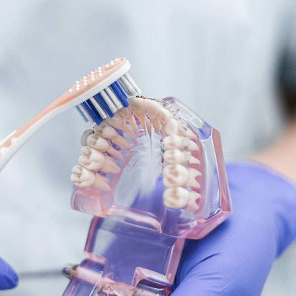 Dental implant model showing tooth replacement