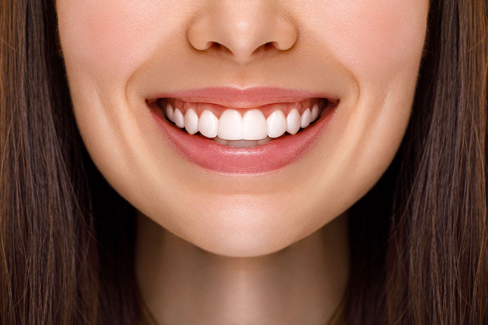 Before and after smile showing cosmetic dental results